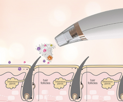 Electric Blackhead Remover